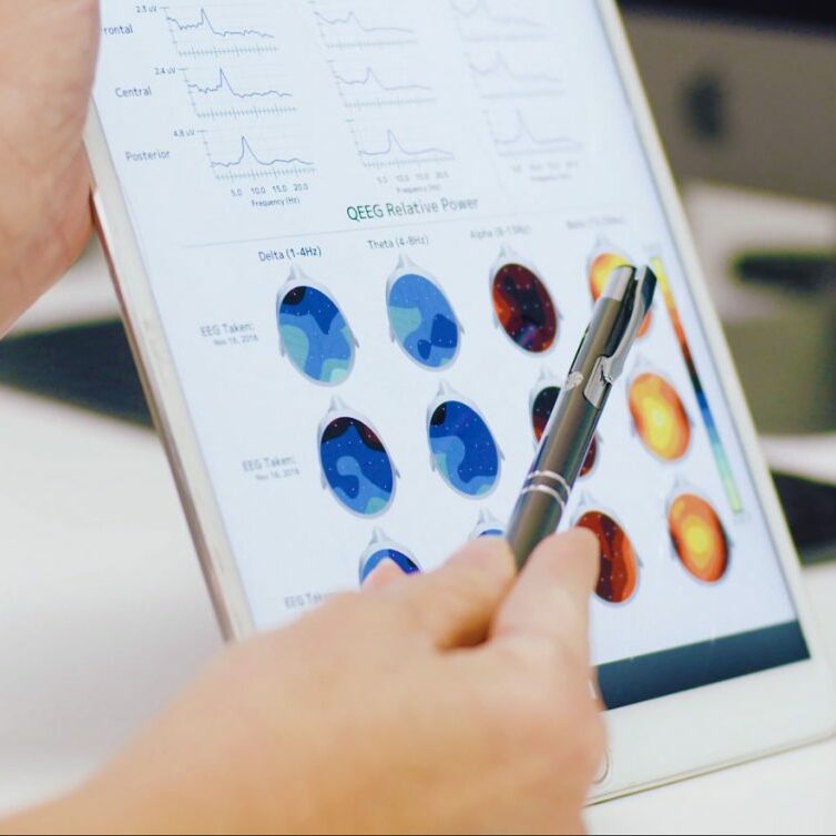 EEG test results